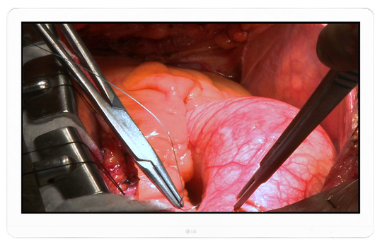 LG 27HJ710S 27" SURGICAL UHD IPS DVI/DP/HDMI